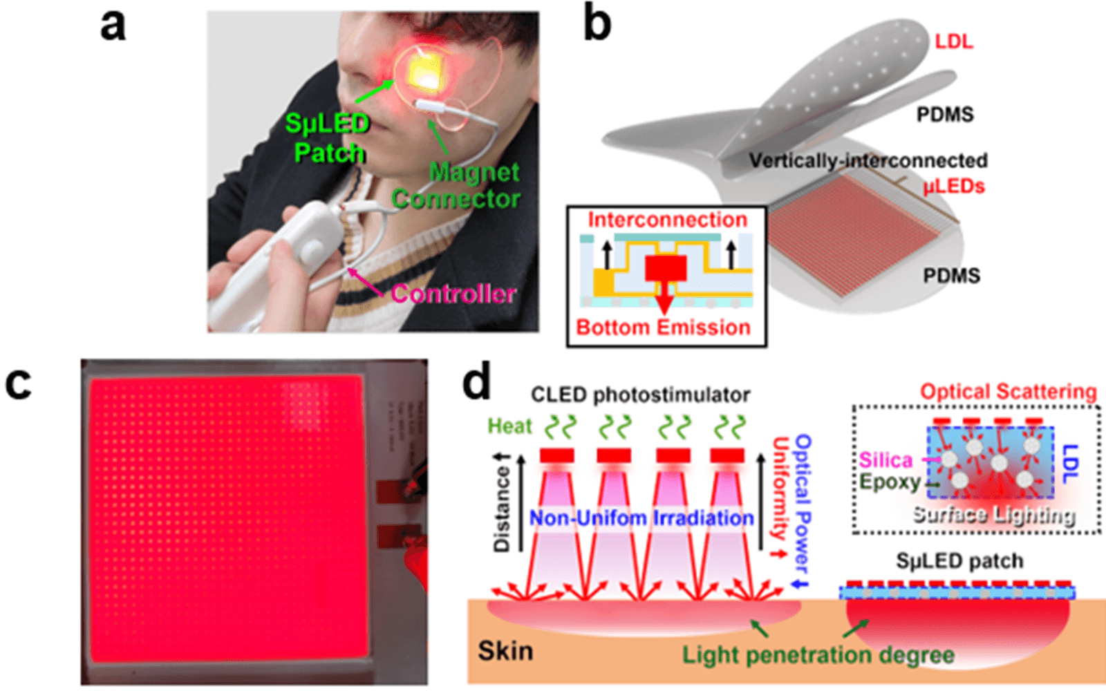 The overall concept of SµLED patch. a) SµLED patch operated on the human skin. b) Schematic illustration of SµLED patch structure. c) 4 × 4 cm2-sized SµLED patch. d) Schematic illustration of the advantages of SµLED patch such as efficient light…