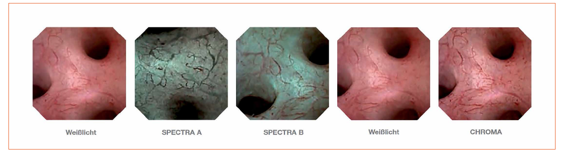 Challenges when Designing LED-Based Illumination Systems in Medical Applications and Diagnostics
