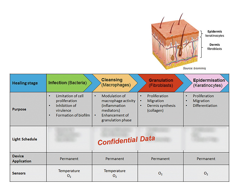 Flex LED Based Smart Light System for Healing of Chronic Wounds
