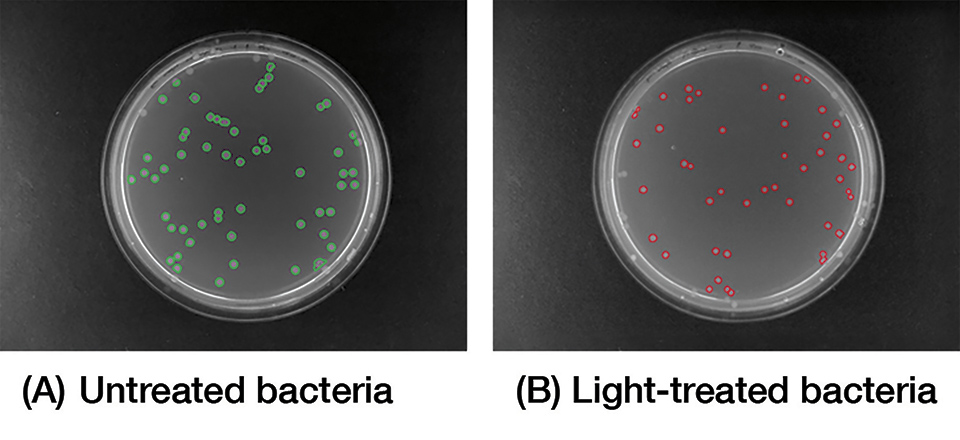 Flex LED Based Smart Light System for Healing of Chronic Wounds