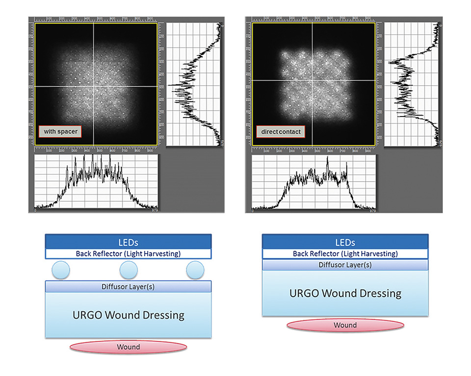 Flex LED Based Smart Light System for Healing of Chronic Wounds