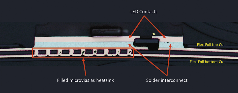 Flex LED Based Smart Light System for Healing of Chronic Wounds