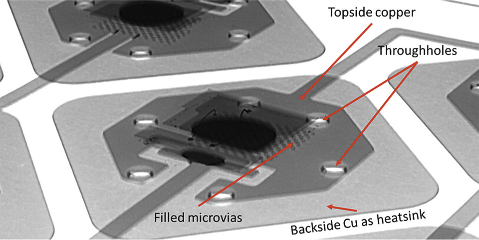 Flex LED Based Smart Light System for Healing of Chronic Wounds