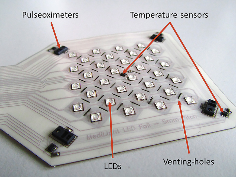 Flex LED Based Smart Light System for Healing of Chronic Wounds