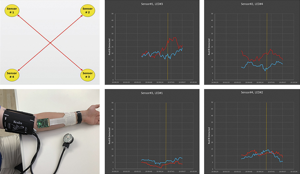 Flex LED Based Smart Light System for Healing of Chronic Wounds