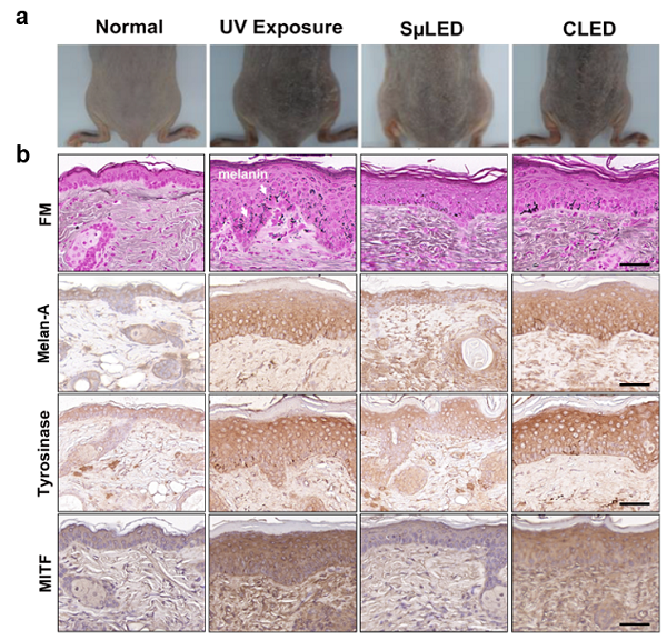 KAIST Team Develops Surface-Lighting MicroLED Patch with Significant Melanogenesis Inhibition Effect​